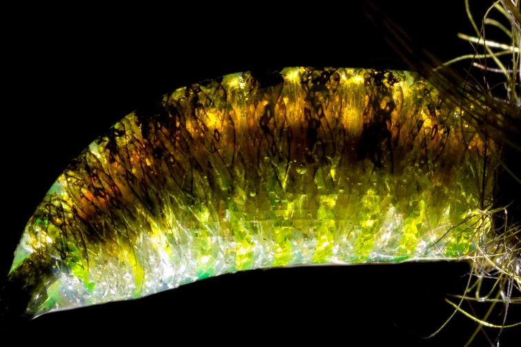 Body structure Body structure